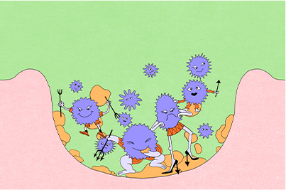 毛穴で繁殖したアクネ菌を