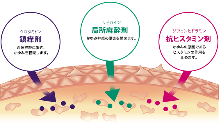 鎮痒剤、局所麻酔剤、抗ヒスタミン剤