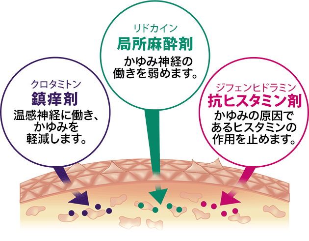 鎮痒剤、局所麻酔剤、抗ヒスタミン剤