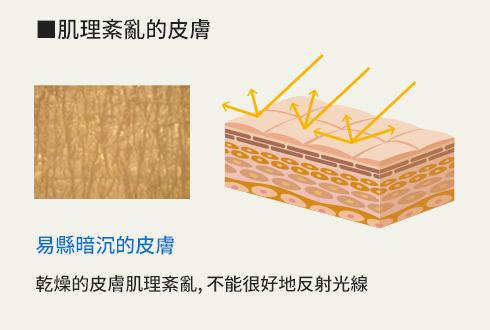 肌理紊亂的皮膚