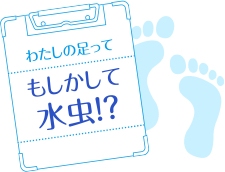 わたしの足ってもしかして水虫！？