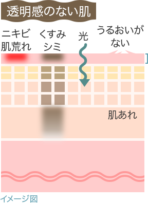 イメージ図：透明感のない肌 肌荒れ くすみ シミ 光 うるおいがない