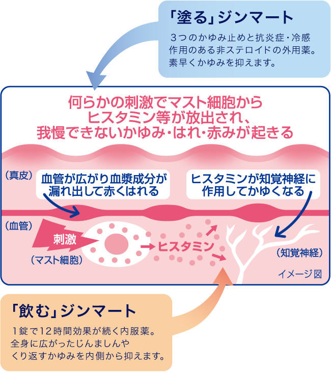 じんましんのはれとかゆみの発生するメカニズム