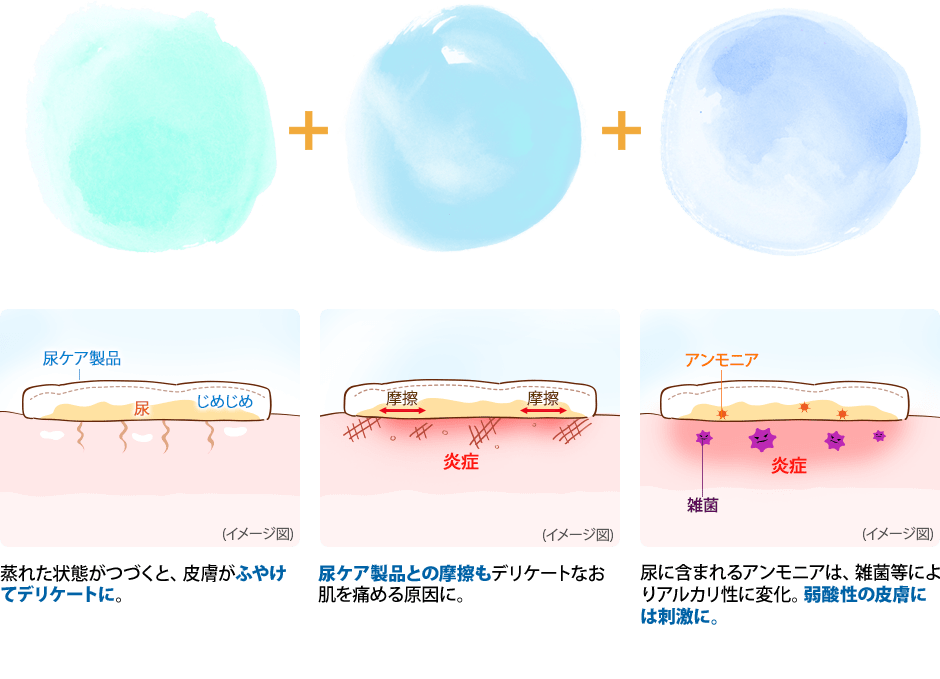 蒸れた状態がつづくと、皮膚がふやけてデリケートに。尿ケア製品との摩擦もデリケートなお肌を痛める原因に。尿に含まれるアンモニアは、雑菌等によりアルカリ性に変化。弱酸性の皮膚には刺激に。