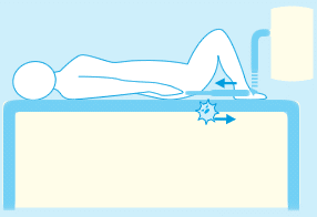 クローズドタイプ