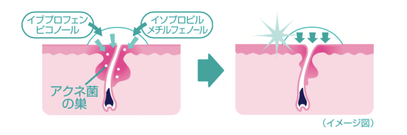 尿素20％＋トコフェロール＋グリチルリチン酸二カリウム＋ビタミンA油