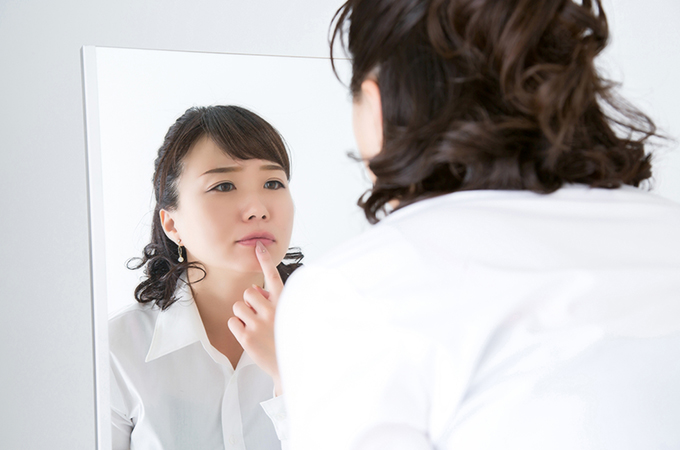 口角炎・口唇炎について