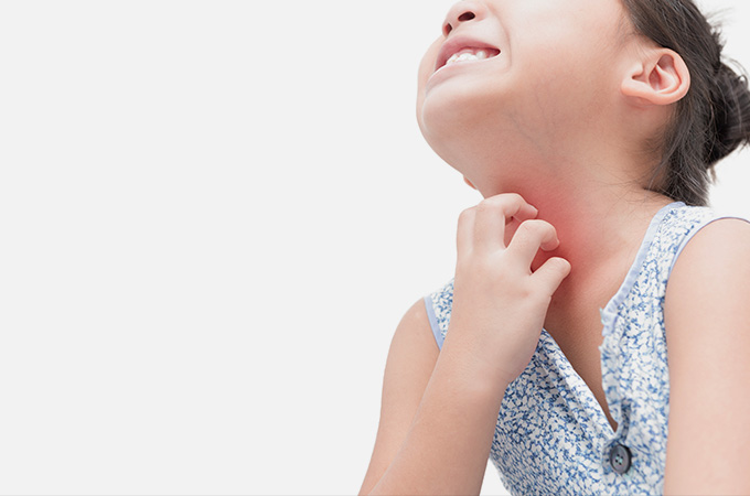 アトピー性皮膚炎の主な症状