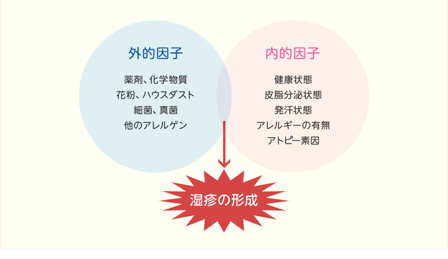 湿疹を形成する因子