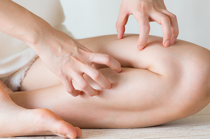 蕁麻疹が起こりやすい箇所