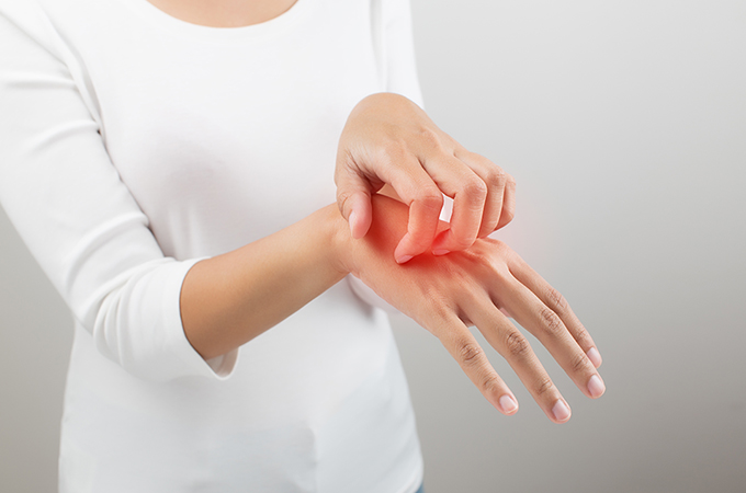 かぶれ（接触皮膚炎）の種類