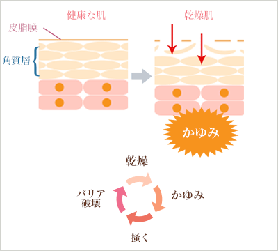 肌本来のバリア機能