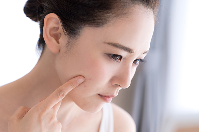 肌荒れの症状（疾患）