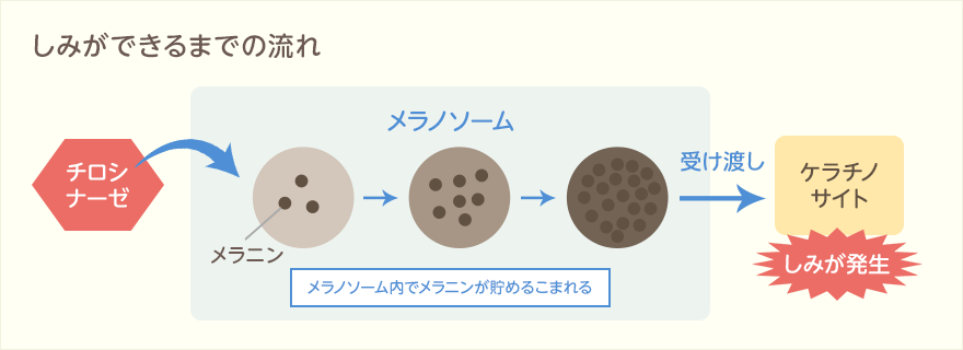 しみができるまでの流れ