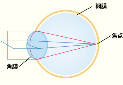 乱視のない角膜