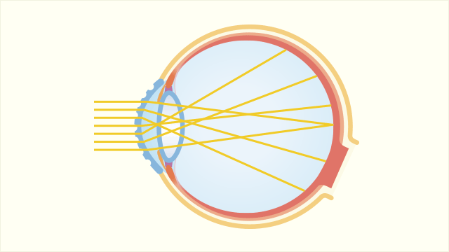 不正乱視のイメージ