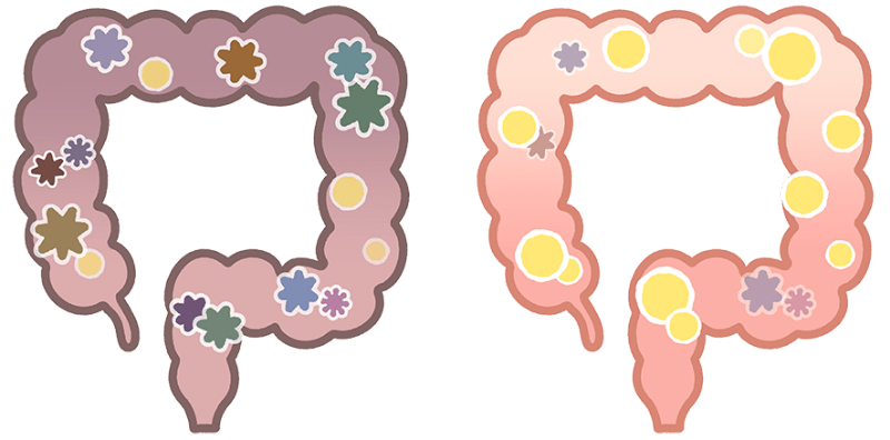 善玉菌と悪玉菌って？