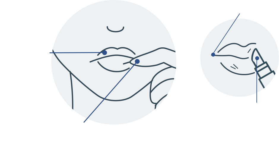 口角炎・口唇炎