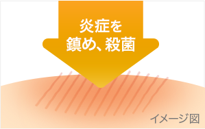 図：かゆみの元となる炎症を鎮め、患部を殺菌する成分配合。炎症を鎮め、殺菌