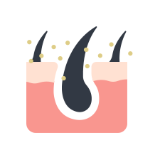 パラパラとしたフケが気になる