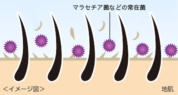 マラセチア菌などの常在菌 地肌