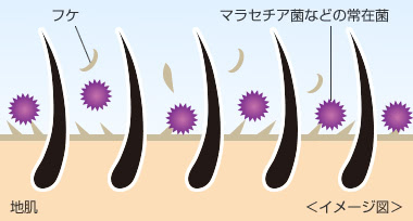 頭皮に潜むマラセチア菌などの常在菌も、フケやかゆみの原因の一つ。人の皮ふに常に存在する菌で、皮脂などを栄養にして増え、脂を分解して皮ふに刺激を与えます。