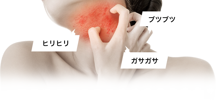 ブツブツ、ヒリヒリ、ガサガサ