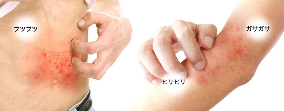 ヒリヒリ ブツブツ ガサガサ