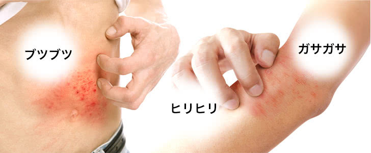 ヒリヒリ ブツブツ ガサガサ