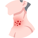 赤みを伴う湿疹