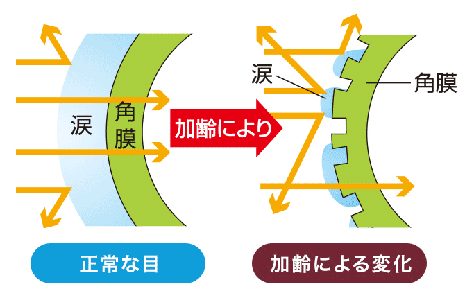 正常な目と加齢により変化した目の比較図