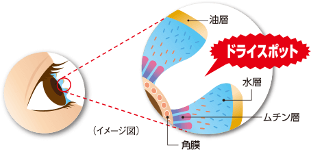 つらいドライアイ（目の乾き）その瞳にはドライスポットが！