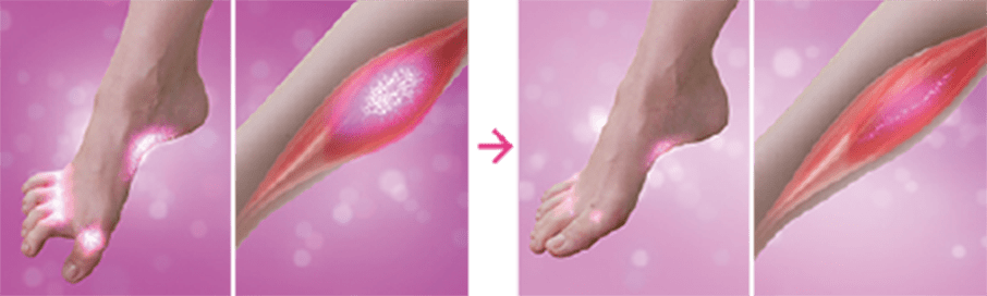 ツラレスはそんな症状に芍薬甘草湯の働きで内側からアプローチ！