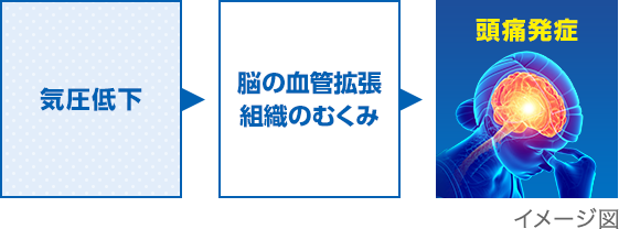 天気頭痛 ※低気圧頭痛