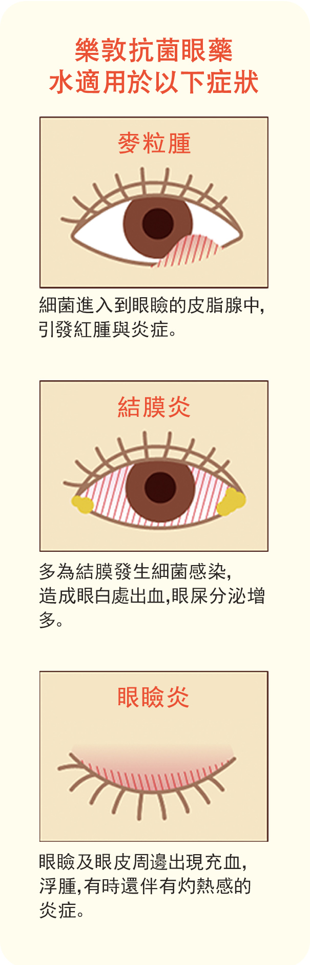樂敦抗菌眼藥水適用於以下症狀
