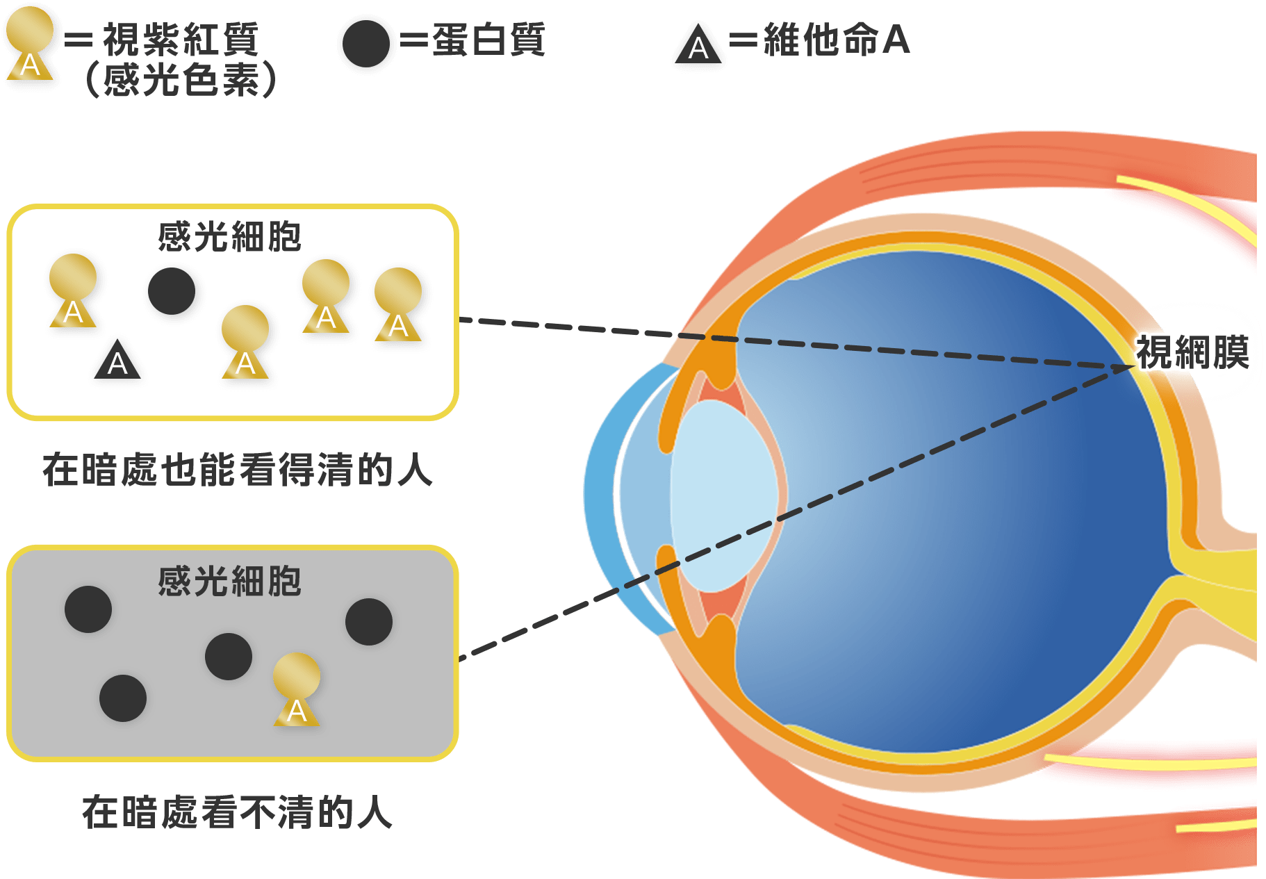 夜盲症、夜間視力低下的原因