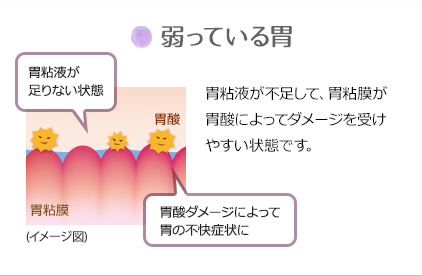 弱っている胃：胃粘液が不足して、胃粘膜が胃酸によってダメージを受けやすい状態です。(胃粘液が足りない状態)(胃酸ダメージによって胃の不快症状に)