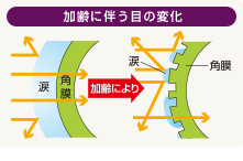 加齢に伴う目の変化